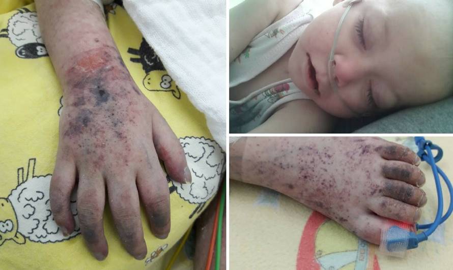 Mama curice koja je umrla od ospica: 'Cijepite svoju djecu...'