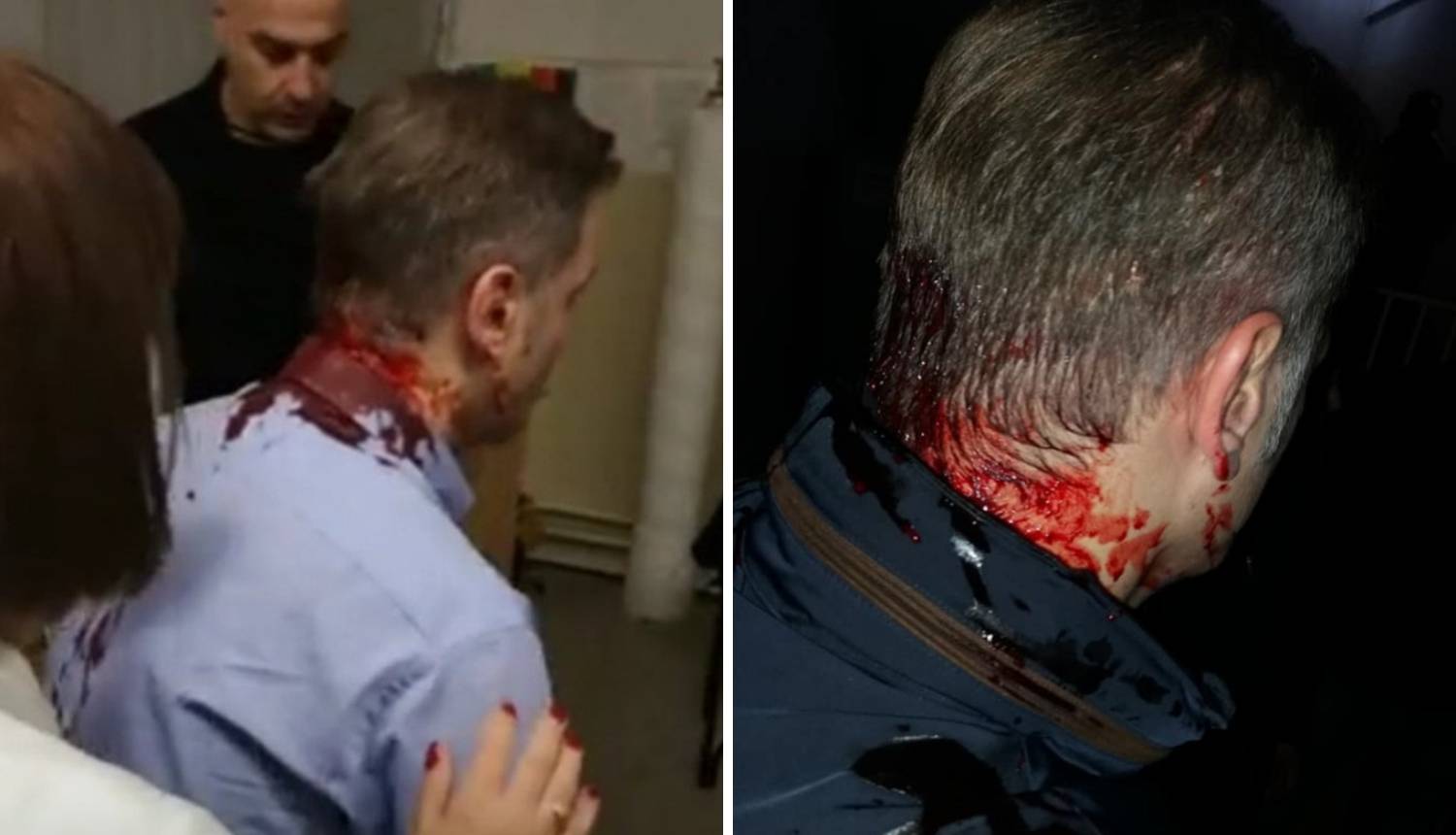 Napali političara u Srbiji: Glava mu je krvava, tukli ga letvama