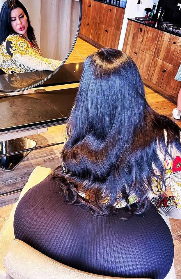 FOTO Stražnjica mi teži 45 kila, no već imam u planu sljedeću operaciju, želim imati najveću!