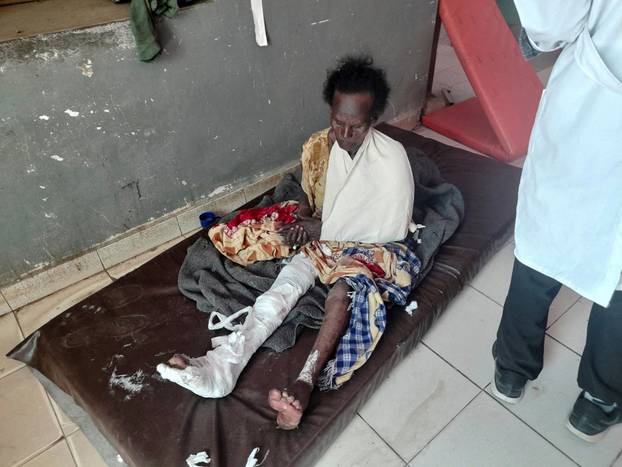 Survivor of air strike by Ethiopian government forces receives treatment at hospital in the town of Dedebit, Tigray region