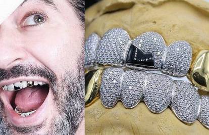 Marc Jacobs dao si je napraviti navlake za zube od dijamanata