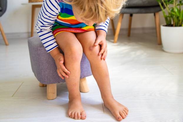 Smrtonosne bolesti koje su još tu iako ljudi misle da su nestale
