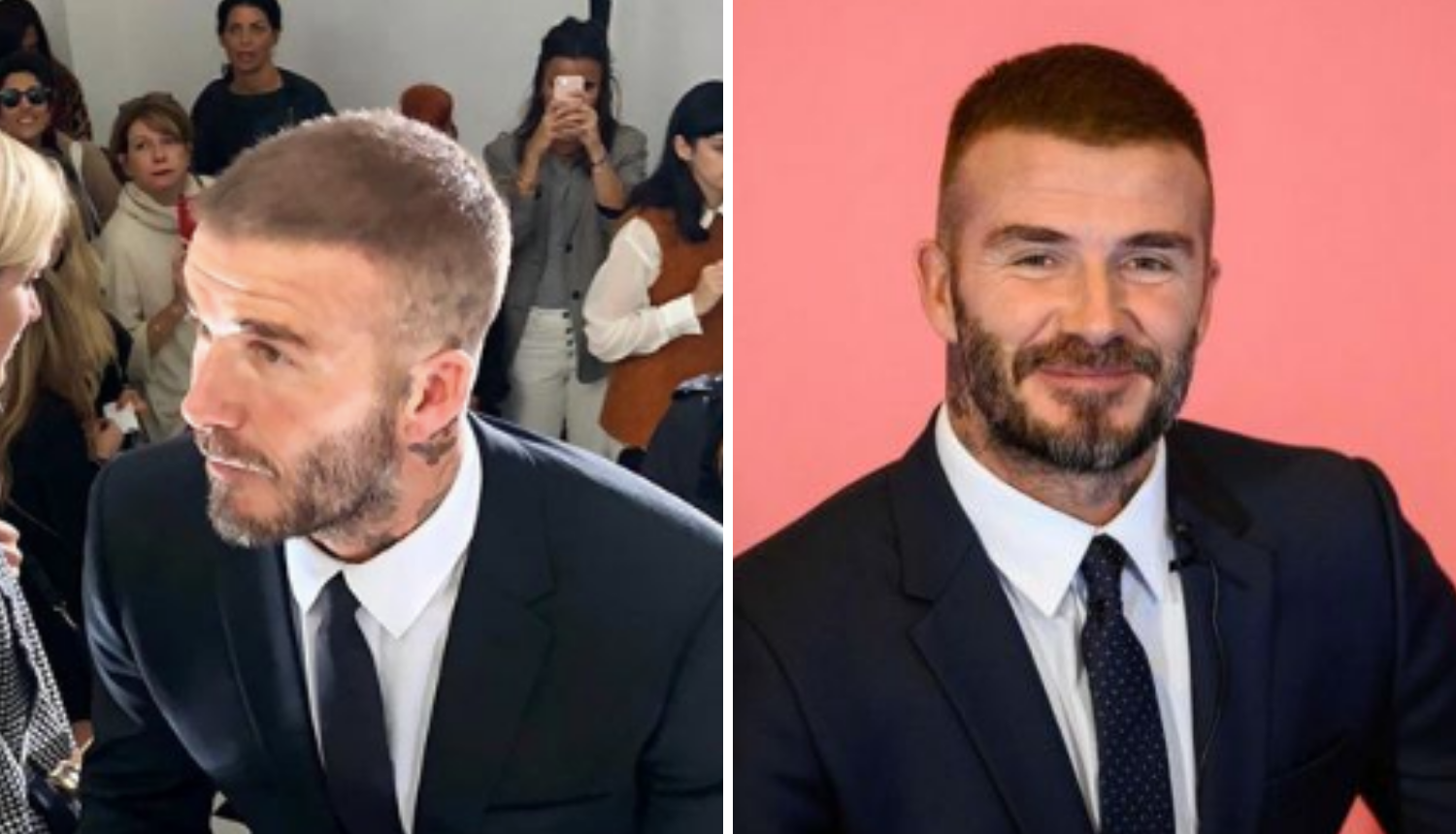 Beckham s gustom, tamnom kosom: Bio na presađivanju?