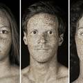 Šokantni UV portreti pokazuju stvarnu štetu od sunca na koži