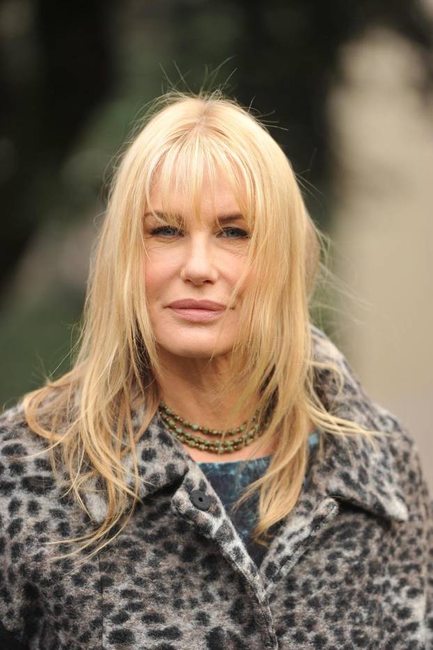 Poznata lica koja su se promijenila zbog velike koli?ine botoksa