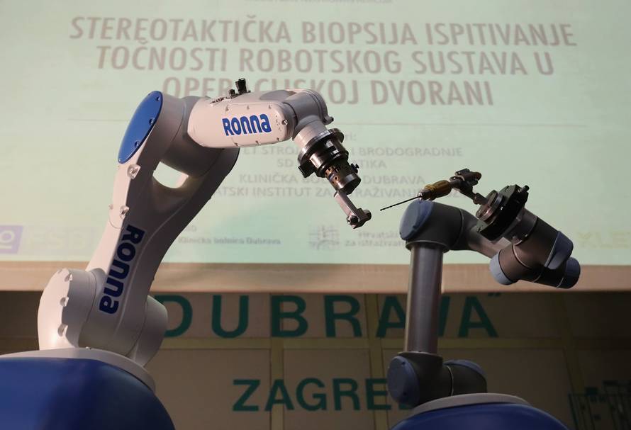 Hrvatski robot Ronna operirao pacijenta s tumorom na mozgu