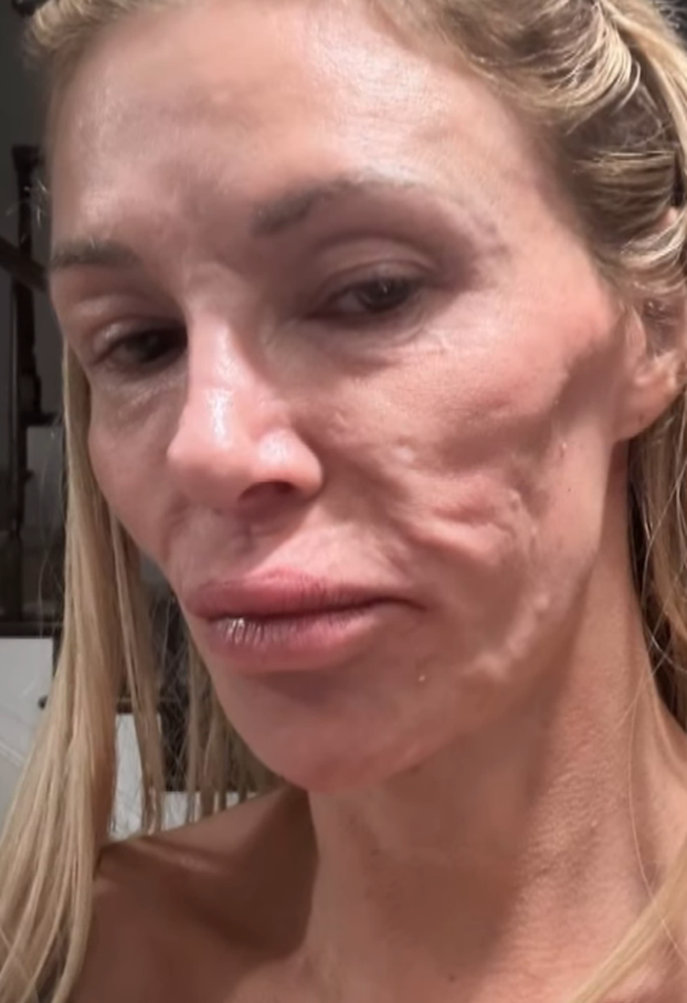 FOTO Ove slavne dame išle su pod nož: Neke su se 'popravile', druge su imale velikih problema