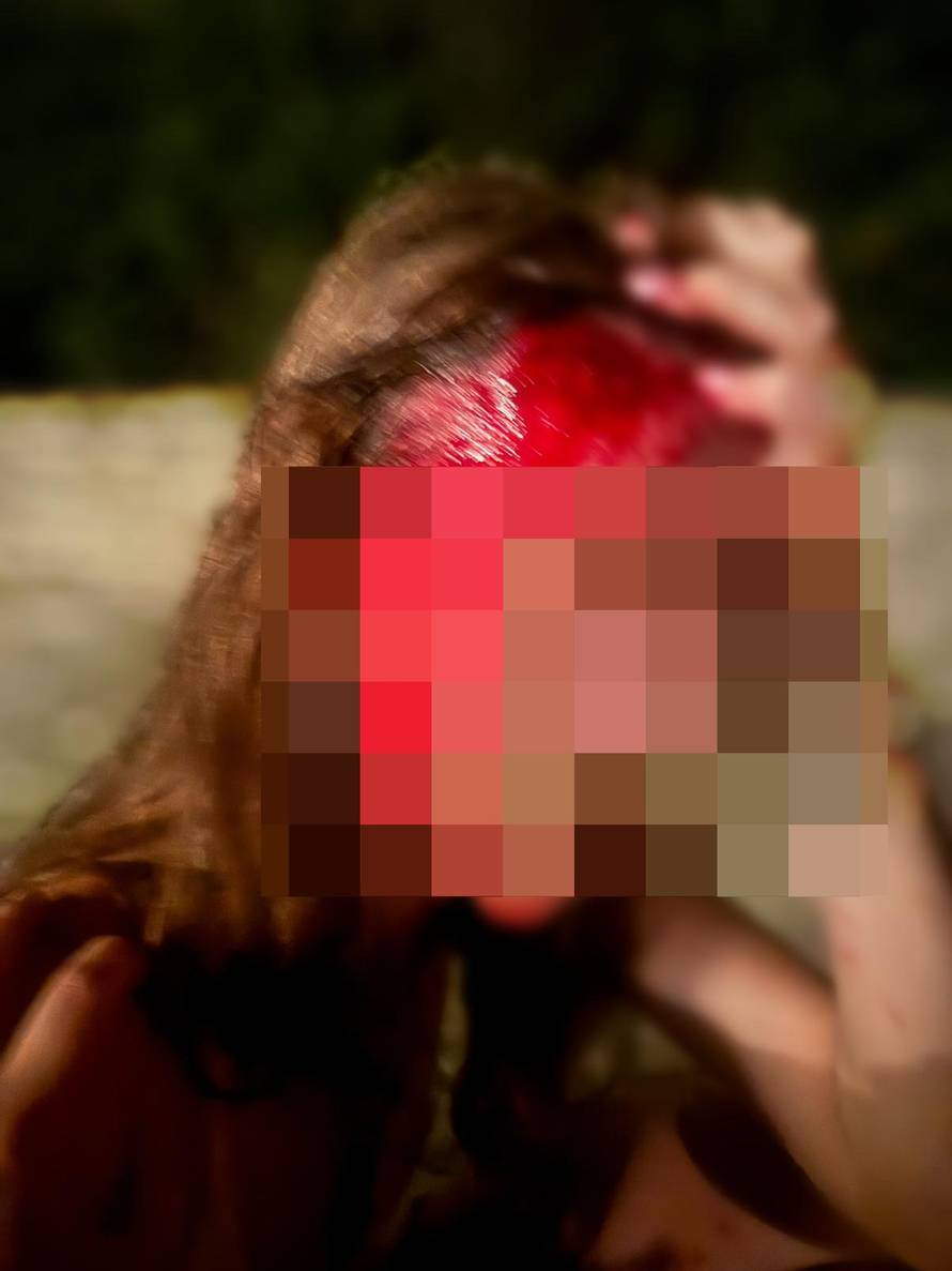 Zaštitari u Savudriji brutalno su istukli Slovence! Nisu ih priveli! Policija: Nismo imali osnove...