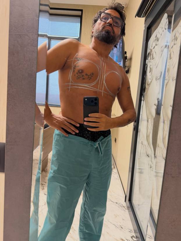 FOTO Ima pjesmu sa Severinom, stavio silikone u prsa, presadio i dlake: Ovako se mijenjao Azis