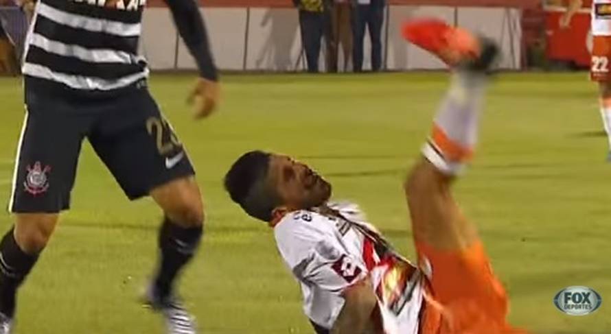 Ne gledajte ako ste osjetljivi: Pao na ruku, stadion zanijemio