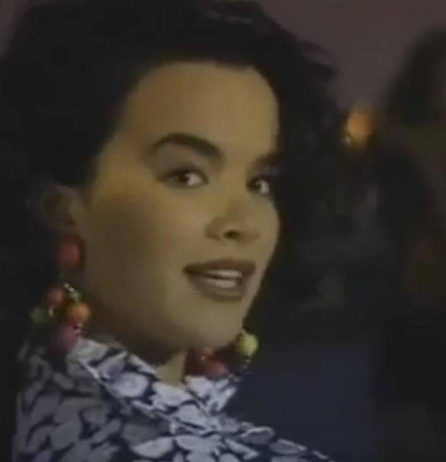 Severina se više ne botoksira, a Šuput se unakazila filerima