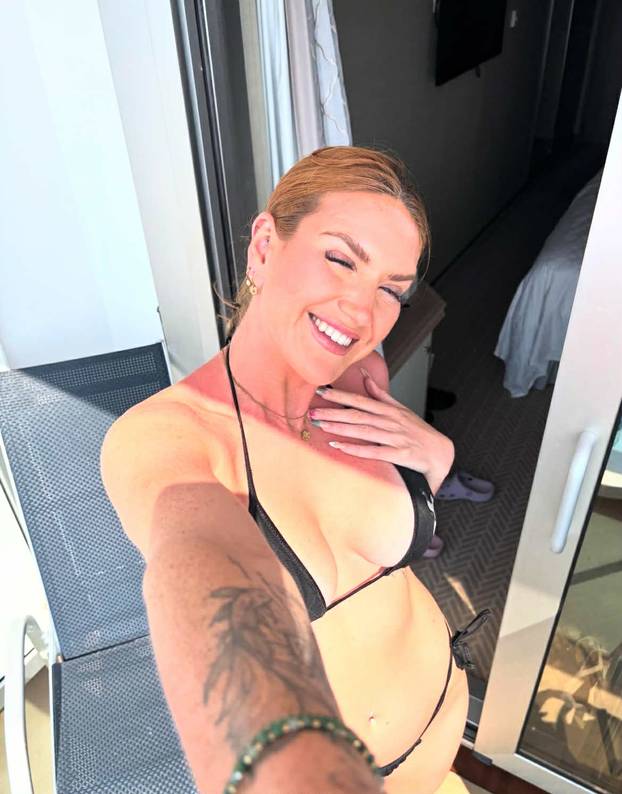 FOTO S dvije vagine i karijerom privlačila sam pažnju, ali ne i ljubav – sad mijenjam sve