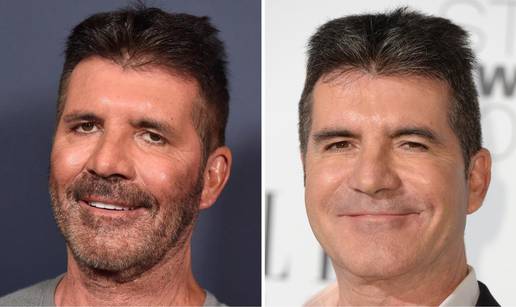 Simon Cowell ponovo šokirao gledatelje, obrazi puniji, a koža zaglađenija: 'Što mu je s licem?'