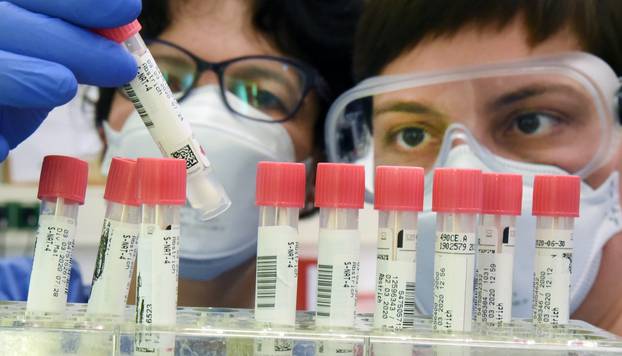Laboratory tests for suspected coronavirus