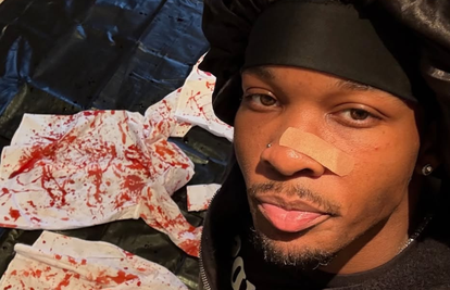 Šok u L.A.-u: U autu glazbenika pronašli raskomadano tijelo