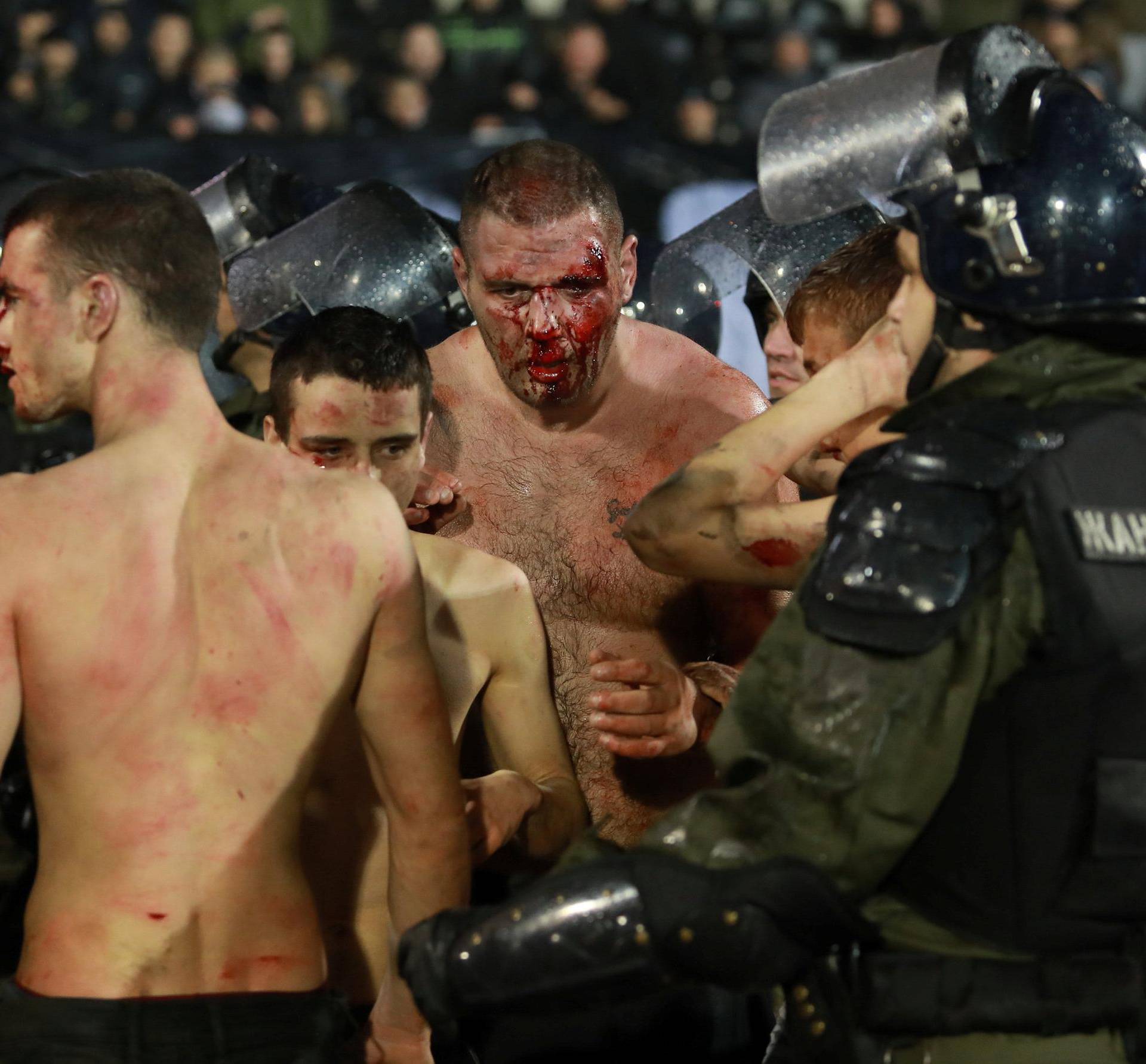 Police escort the soccer fans injured during the fights at a match between Red Star and Partizan in Belgrade