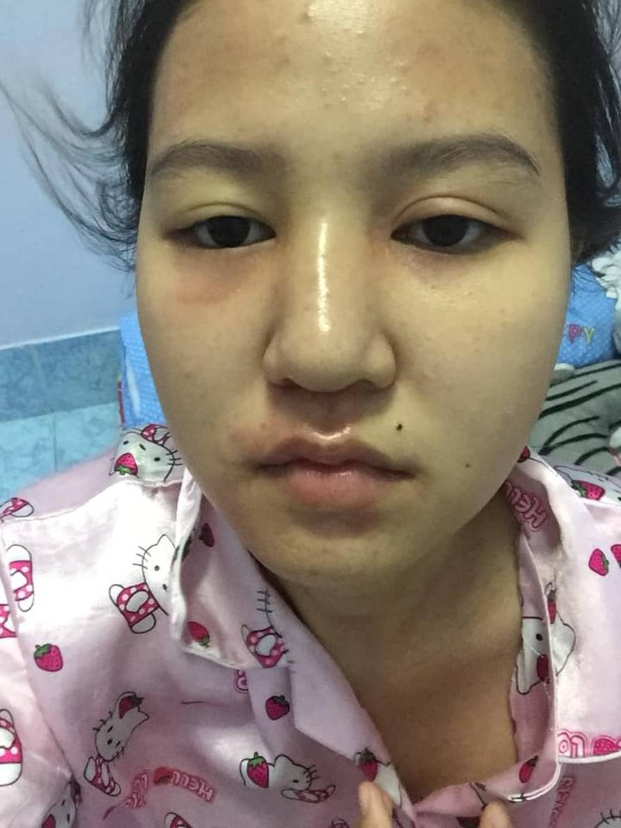 'Stanje je nepodnošljivo, zbog smoga svi krvarimo i kašljemo'