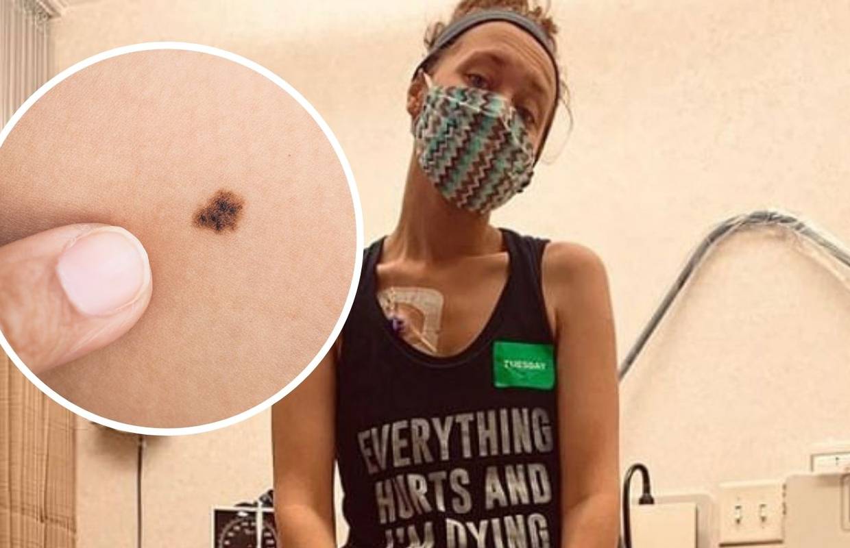 Majka (27) umire od raka, jer je ignorirala sumnjivi madež: 'Ne bojim se, samo sam tužna...'