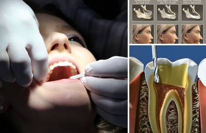 Pogledajte što zubar zapravo radi dok popravlja zube i kako se lice mijenja kad zubi ispadnu