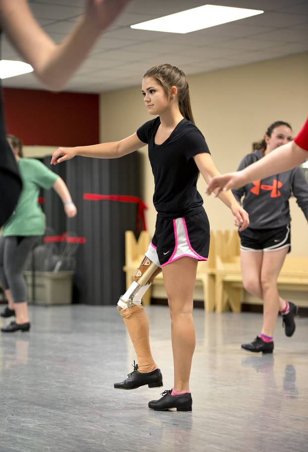Missouri dancer, 15, a cancer survivor with a backward leg, inspires millions worldwide