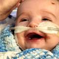 Beba s tumorom u srcu nakon kome se široko nasmijala ocu