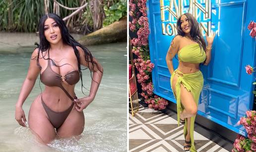 FOTO Opsjednuta estetskim operacijama: '&Zcaron;elim imati stra&zcaron;njicu poput Nicki Minaj!'