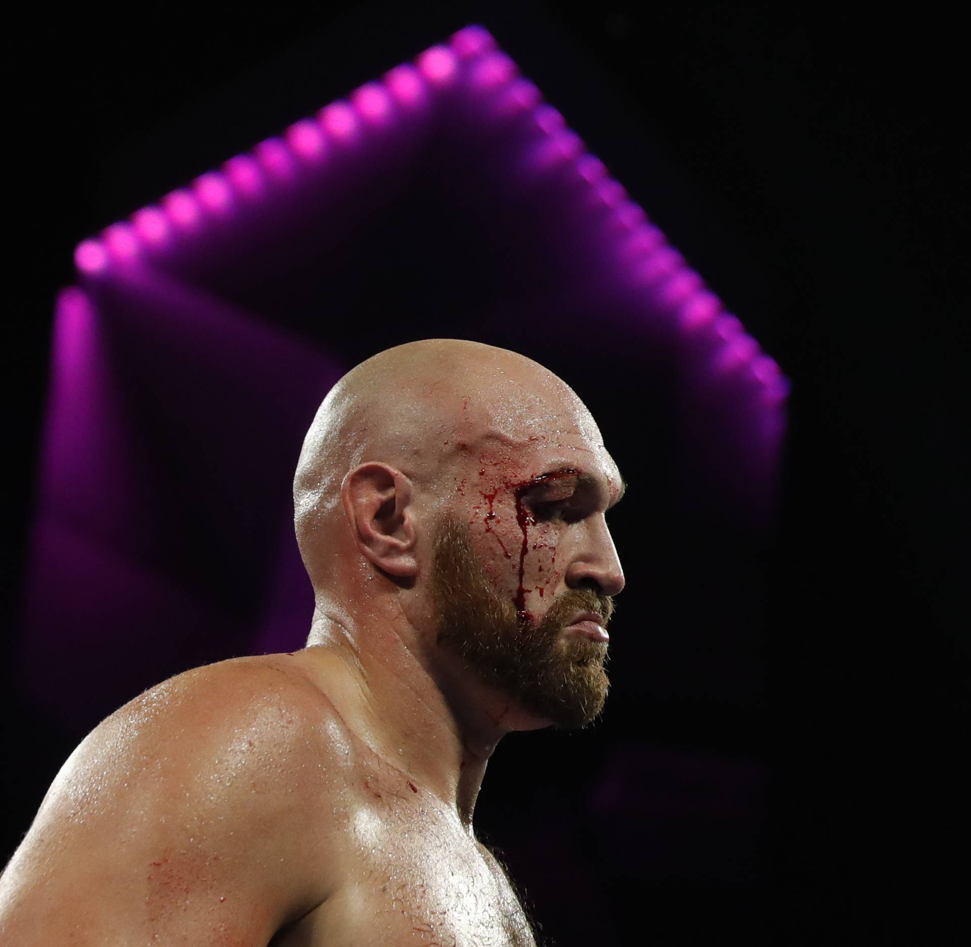 Tyson Fury v Otto Wallin