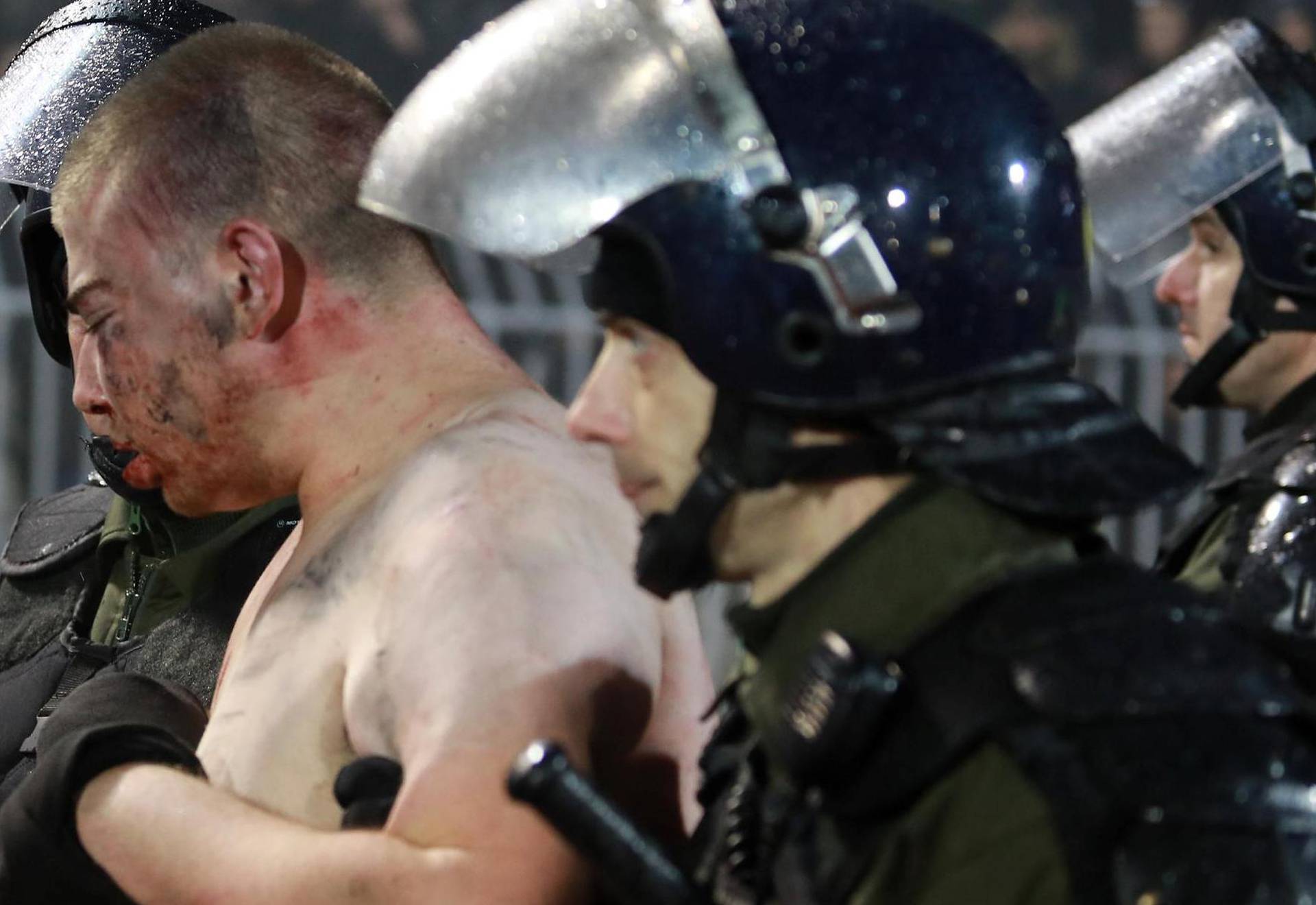 Police escort a soccer fan injured during the fights at a match between Red Star and Partizan in Belgrade