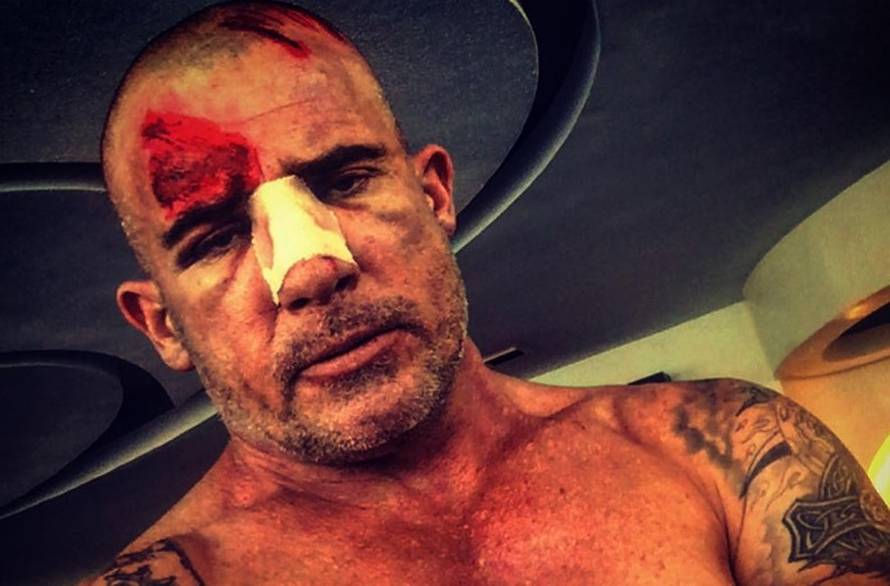 Zvijezda 'Zakona braće' nije skidala ruke sa 17 godina mlađe djevojke: Mazili su se na plaži