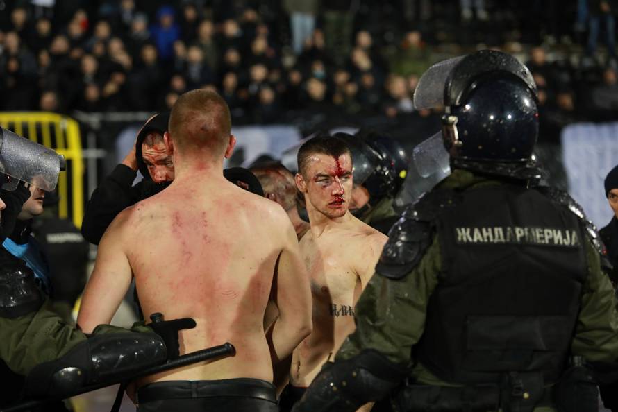 Police escort the soccer fans injured during the fights at a match between Red Star and Partizan in Belgrade
