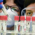 Japanci razvijaju lijek protiv korona virusa iz krvne plazme