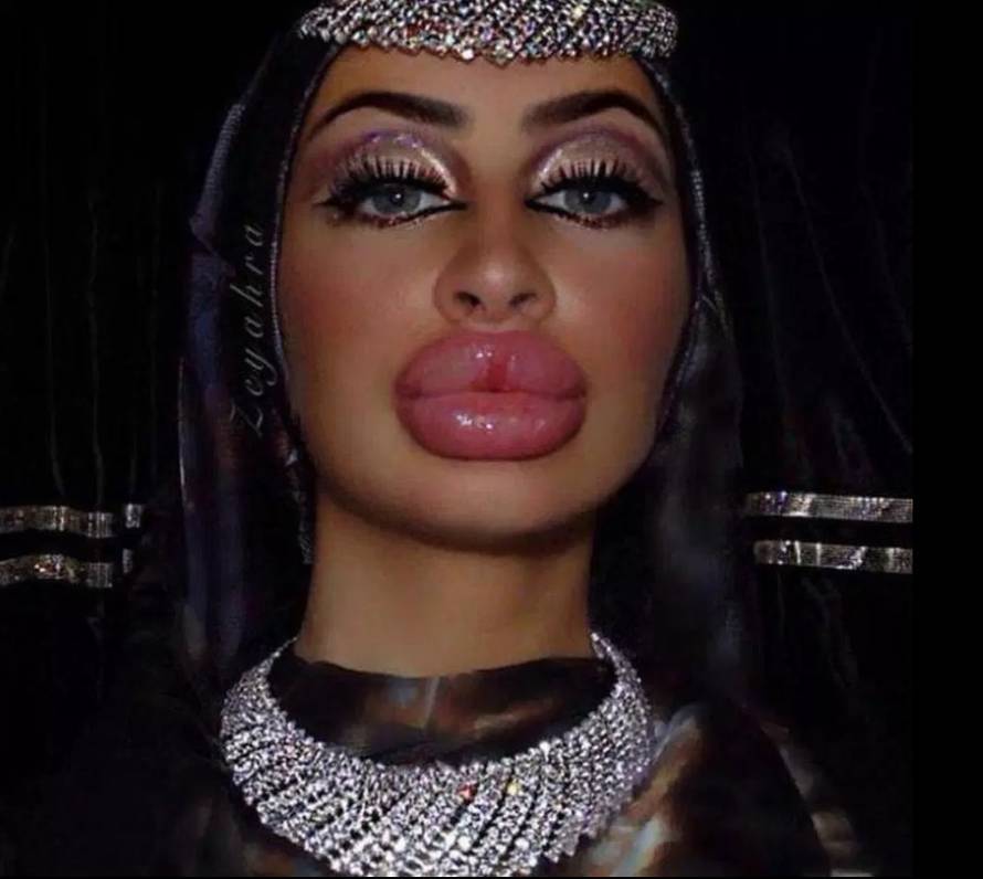 Pretjerale su s filerima: Zovu ih 'jeftinim porno glumicama'