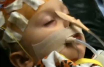 Čudo od djeteta (2): Preživio odvajanje glave od kralježnice