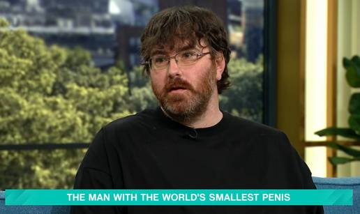 Ispri&ccaron;ao se jer je &zcaron;enama slao fotke svog mikropenisa: Htio sam da odmah znaju na &ccaron;emu su