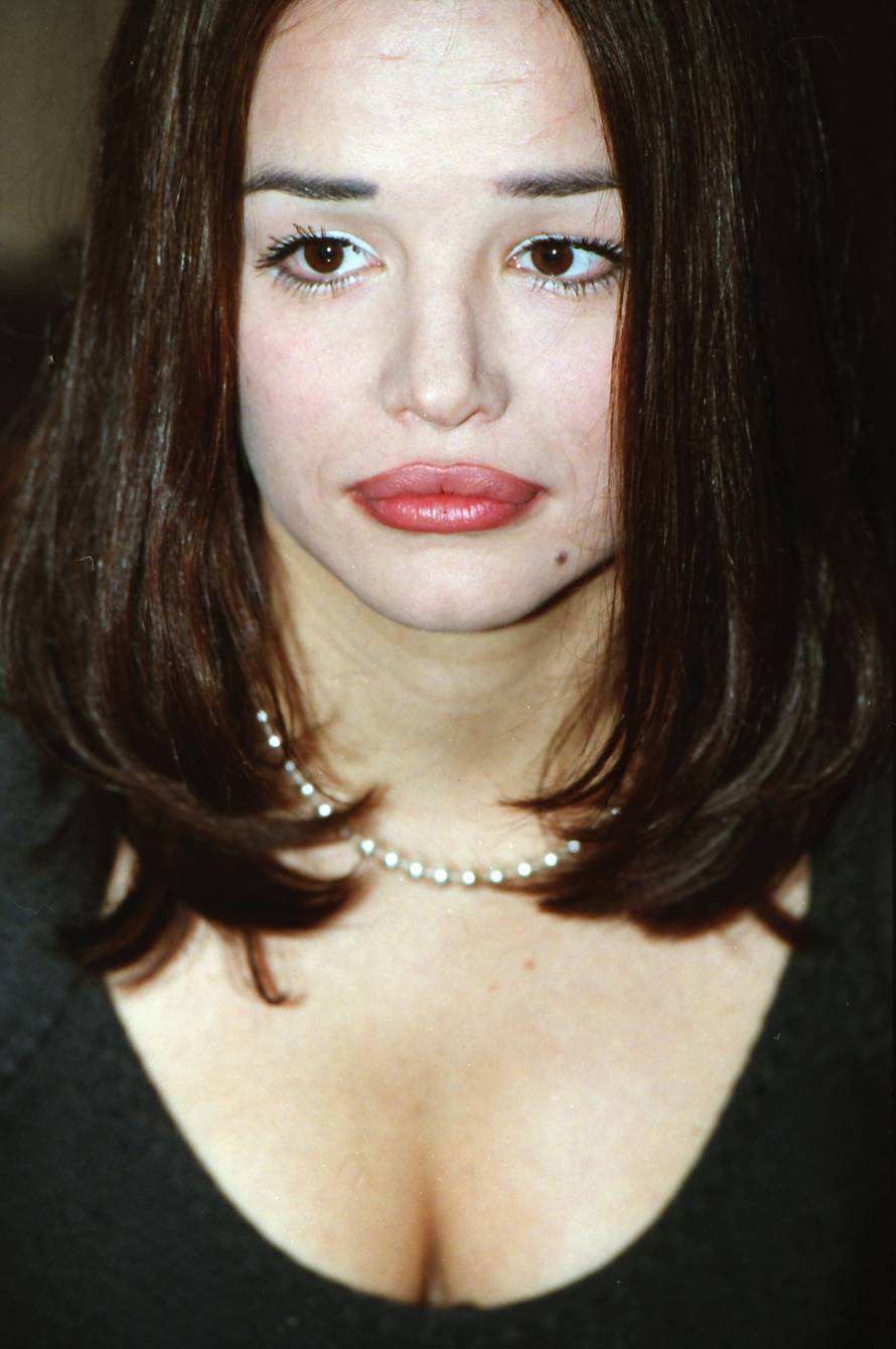 Severina se više ne botoksira, a Šuput se unakazila filerima