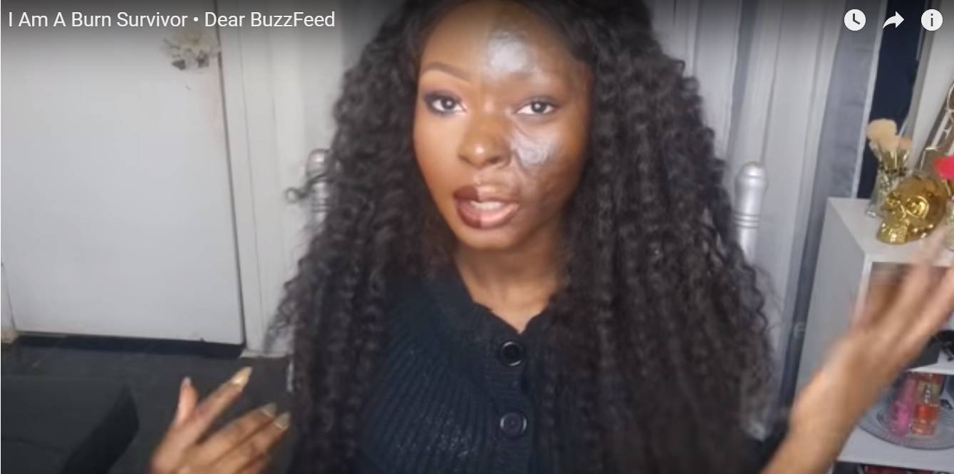 Nevjerojatna transformacija: Šminkom sakrila spaljeno lice