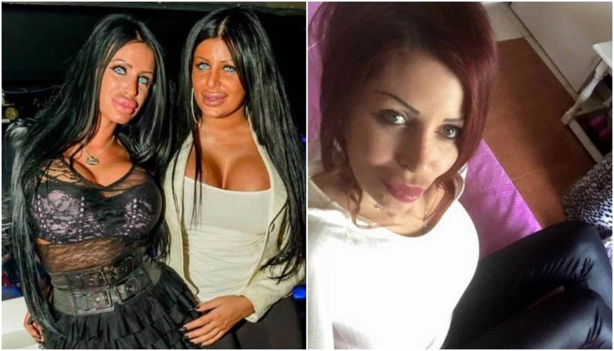 Sjećate li se srbijanske kraljice 'plastike'? Izvadila je silikone...