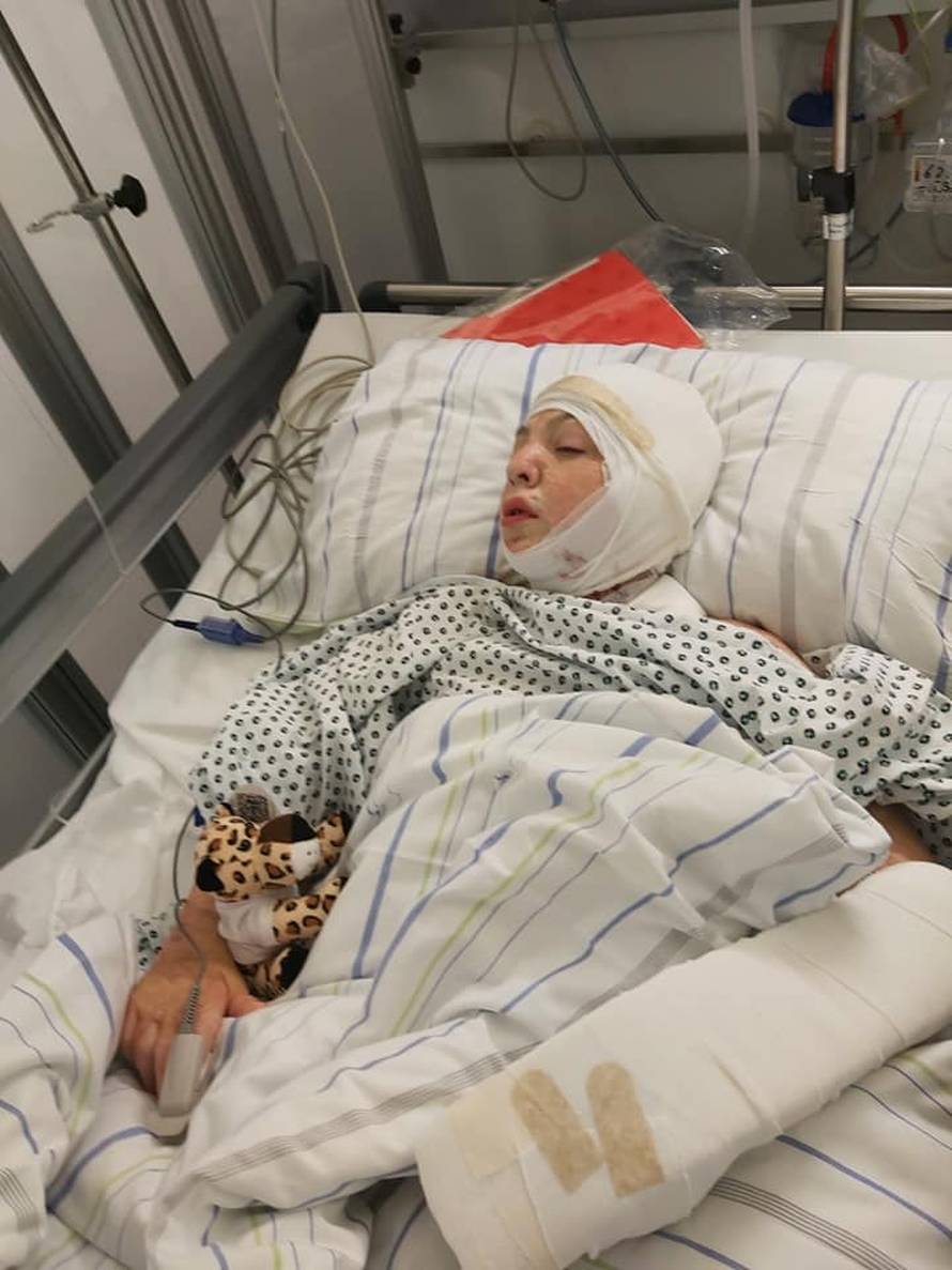 Meho je živ gorio: 'Mogao sam odustati, ali odlučio sam živjeti'