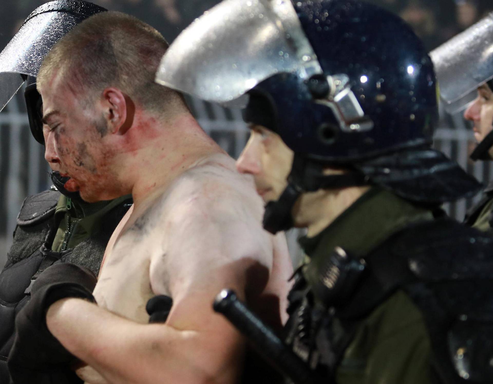 Police escort a soccer fan injured during the fights at a match between Red Star and Partizan in Belgrade