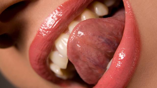 Zubari bi uskoro mogli krunice i proteze raditi u 3D printeru