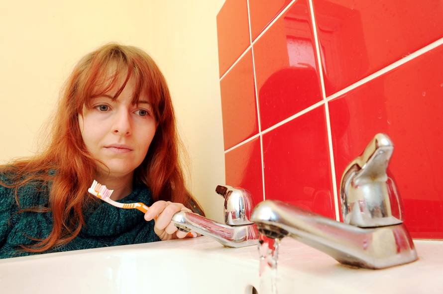 Rachel Prince allergic to water