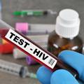 Otkrili novi soj HIV virusa u Nizozemskoj: 'VB varijanta'