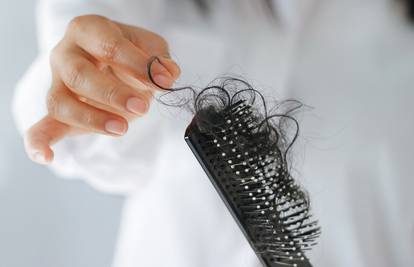 Frizeri otkrili: 5 znakova da vam kosa ispada više od normalnog