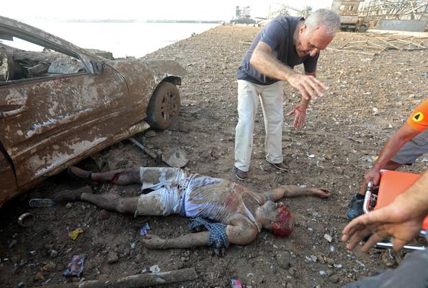 SENSITIVE MATERIAL. THIS IMAGE MAY OFFEND OR DISTURB. An injured man is helped following an explosion in Beirut