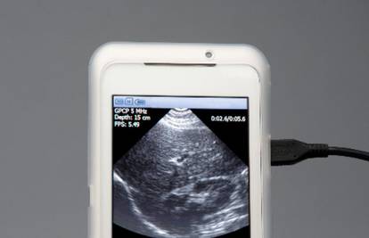 Revolucija za zemlje u razvoju: Ultrazvuk se spaja na mobitel