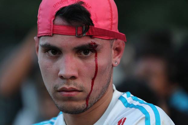 A man with blood on his face is seen after security forces detained him for looting during an ongoing blackout in Caracas