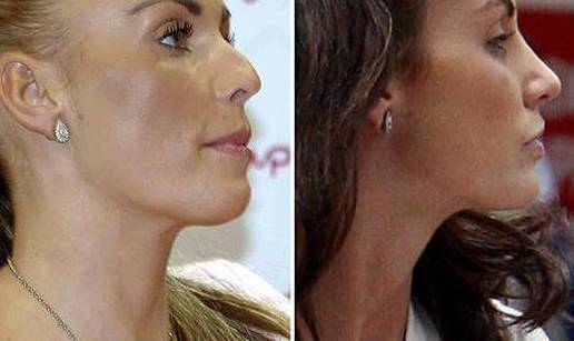 Katie Price transformacije ukupno platila 400.000 kn