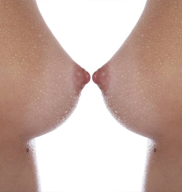 Najčešći simptomi raka dojke koje ne smijete ignorirati