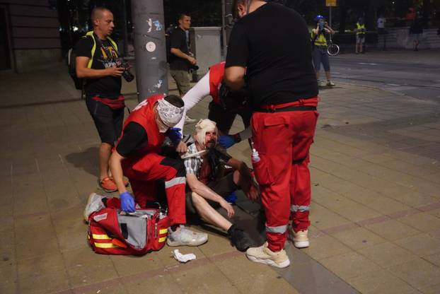 Beograd: Policija rastjerala građane koji su bili okupljeni u Ulici Kneza Miloša, nekoliko građana ozlijeđeno