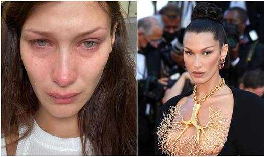 Bella Hadid na odvikavanju od alkohola nakon što je priznala da se više ne može kontrolirati